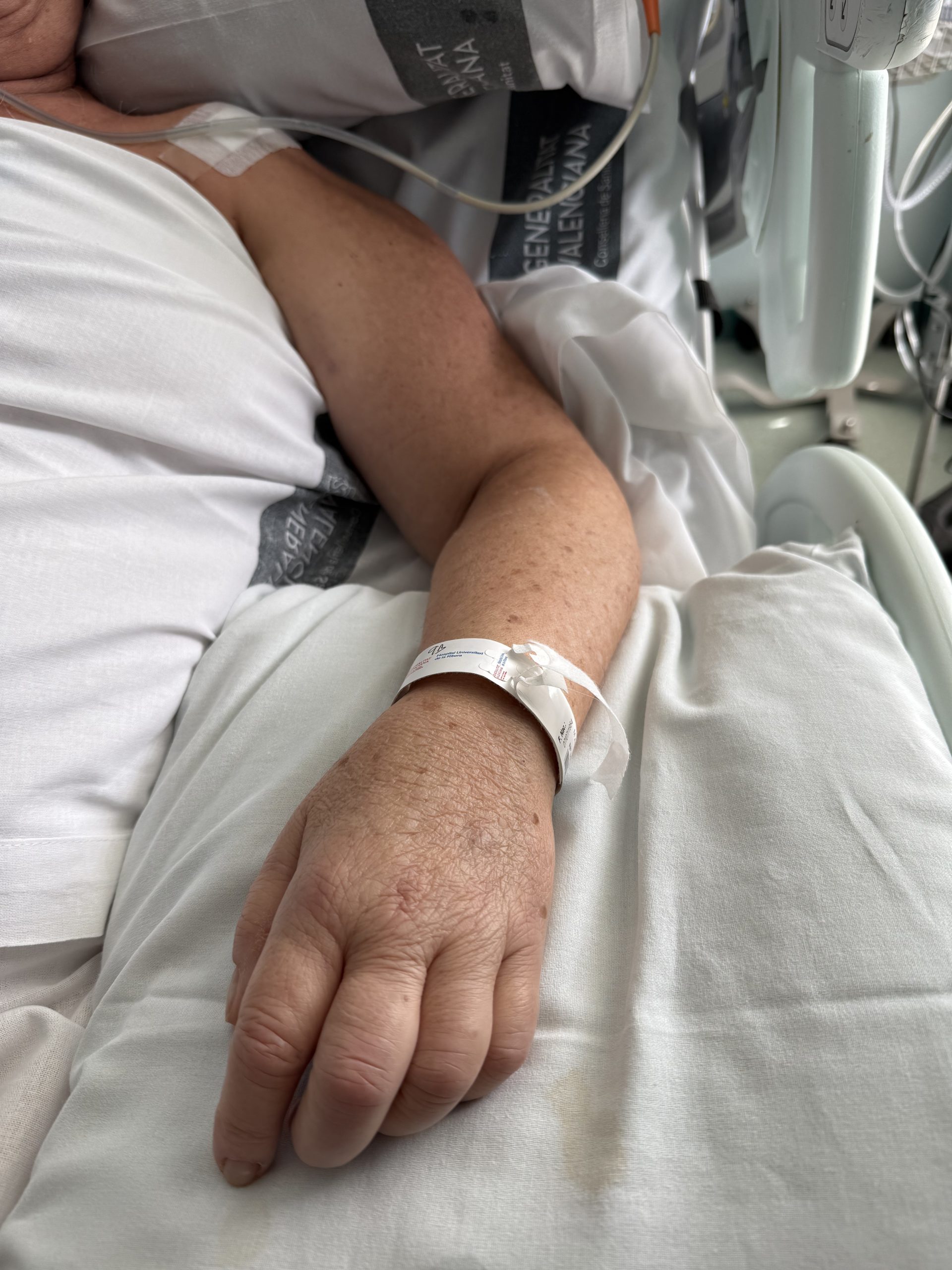 L’Hospital de la Ribera registra 154 casos d’ictus durant el 2025